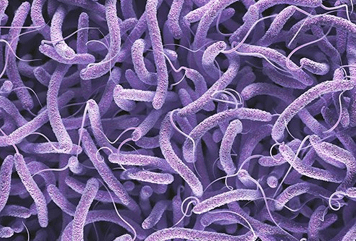 Vibrio Cholerae Metabolome Analysis Service