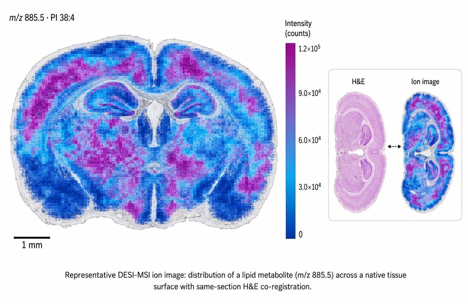 Representative DESI-MSI ion image of native tissue surface with histology overlay