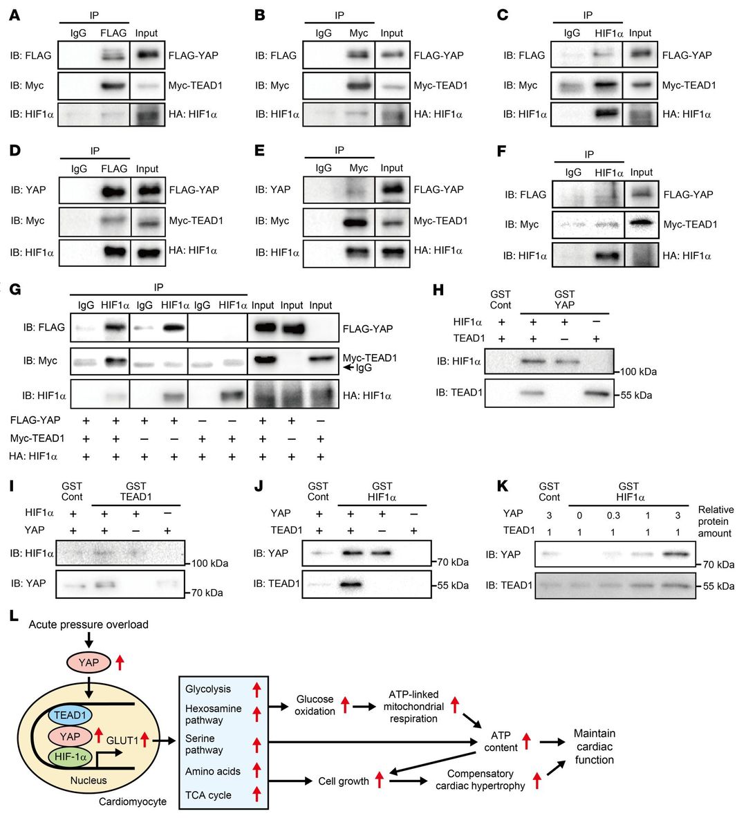 Schematic model of YAP-mediated metabolic reprogramming and glycolytic flux redirection
