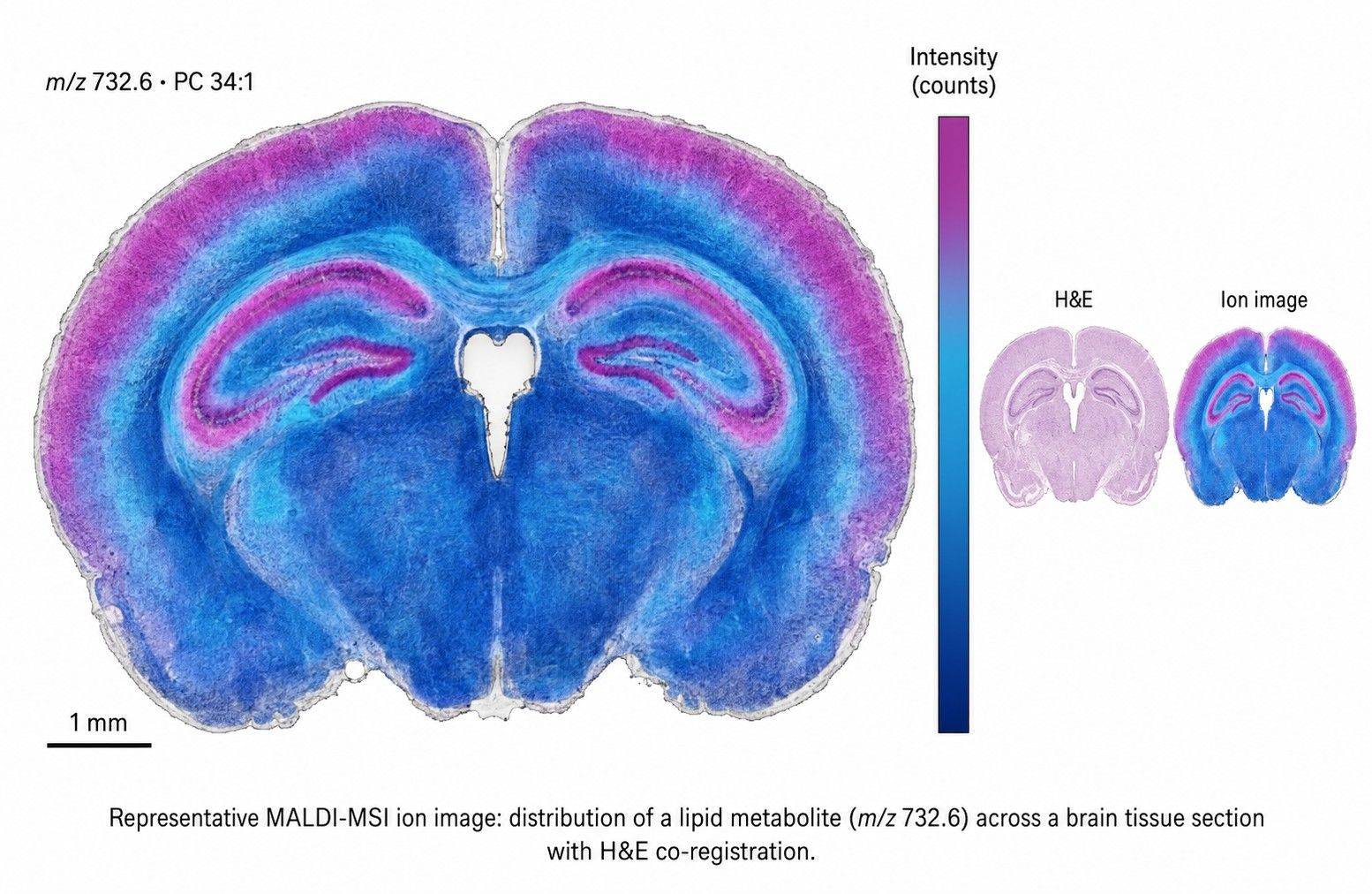 Representative MALDI ion image of metabolite distribution on a tissue section