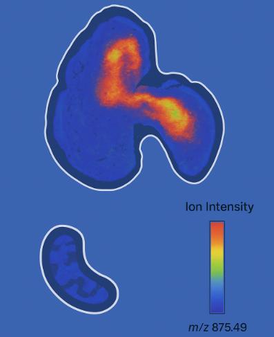 Ion image showing the spatial localization of a metabolite in tissue, with color scale from blue (low intensity) to red (high intensity) and m/z value label.