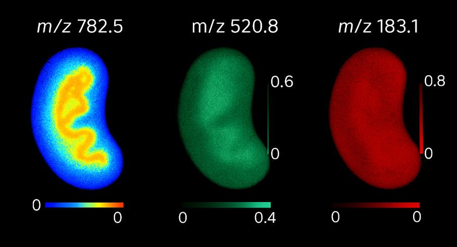 Set of three ion images of tissue sections showing distributions for m/z 782.5 (blue to yellow), m/z 520.8 (green), and m/z 183.1 (red), each with its own intensity scale bar.
